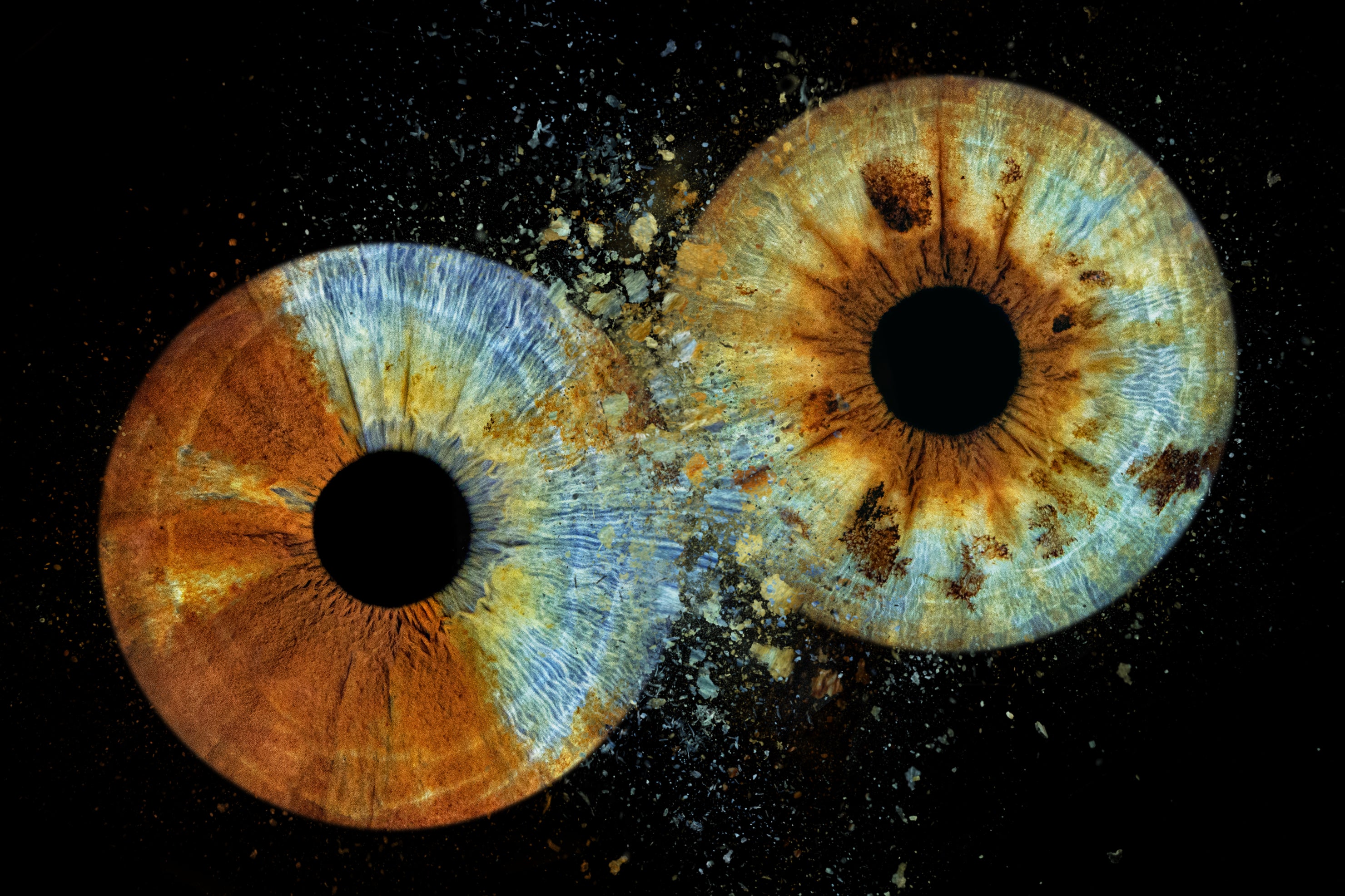 Iris Eye