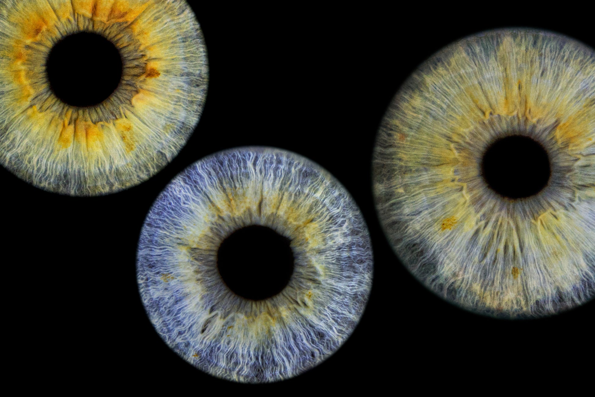 Three Eye Iris Photo